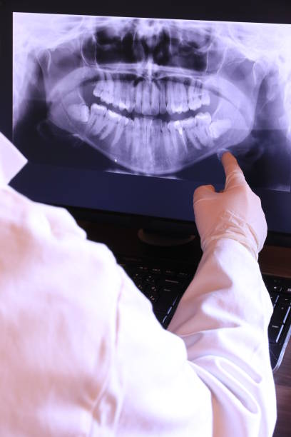 Best Urgent Care for Lost Fillings or Crowns in Fern Prairie, WA