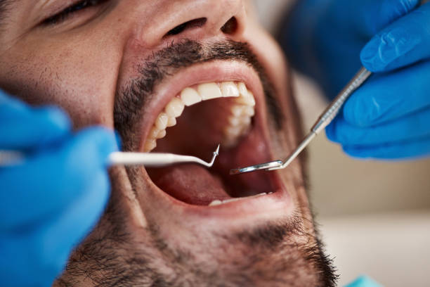 Best Emergency Gum Treatment in Fern Prairie, WA